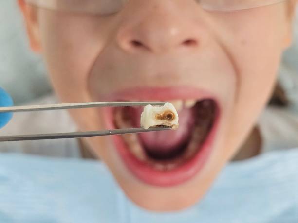 Best Emergency Treatment for Jaw Pain or Injury in Lawrenceville, GA